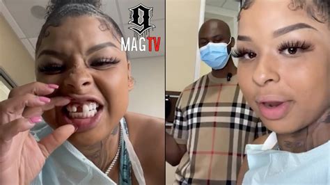 chrisean rock missing tooth|Chrisean Rock Finally Visits Dentist To Fix Her Missing Tooth!